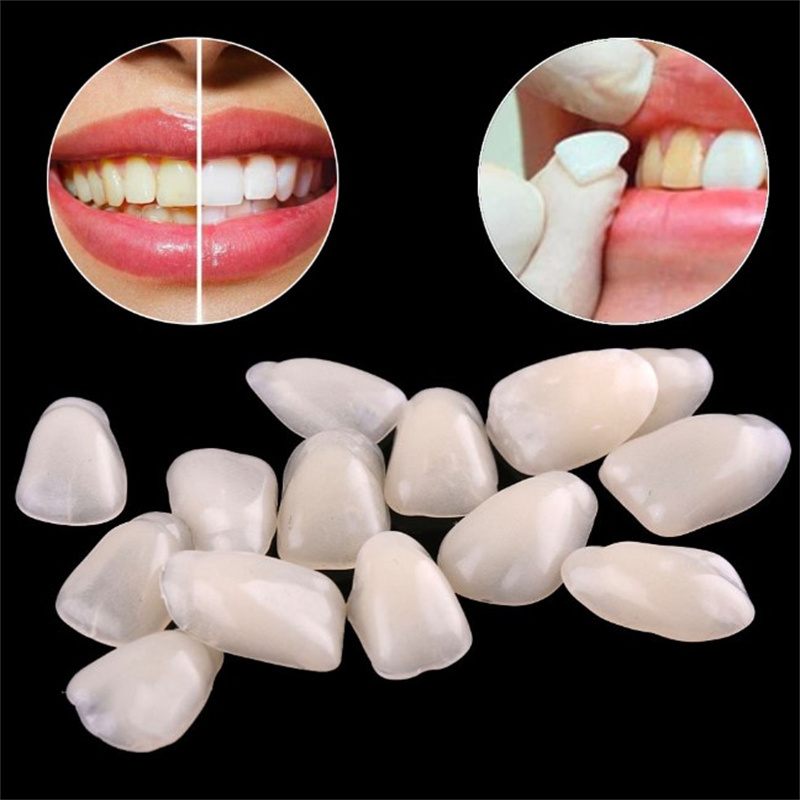 Teeth Whitening Veneers - Chapa dental temporal: cubiertas dentales de