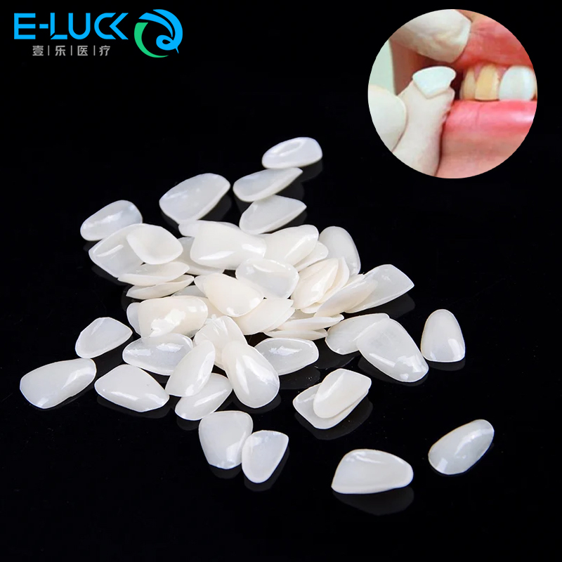 Teeth Whitening Veneers - 50 Uds. De carillas dentales, corona