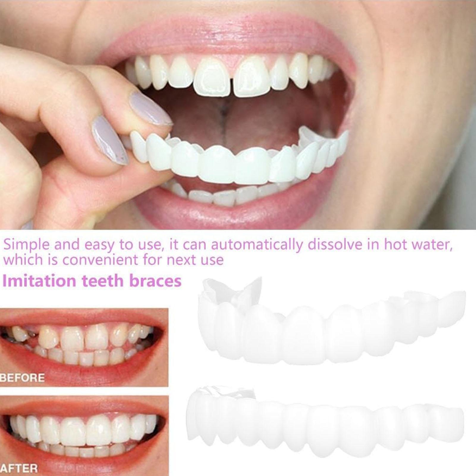 Teeth Whitening Veneers - Chapa de dientes temporal para hombres