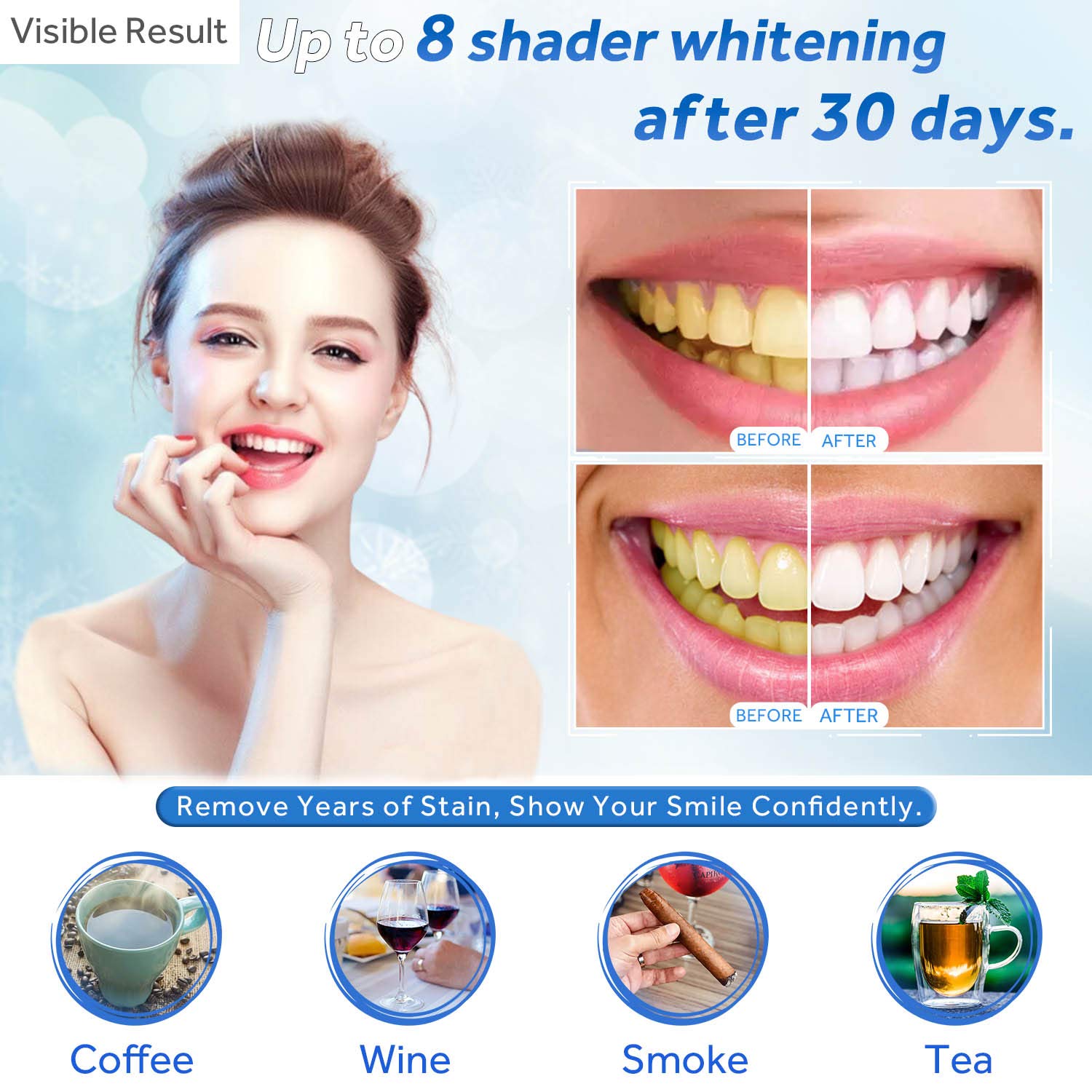Jeringa de repuesto de Gel par - Teeth Whitening App reseña y precio
