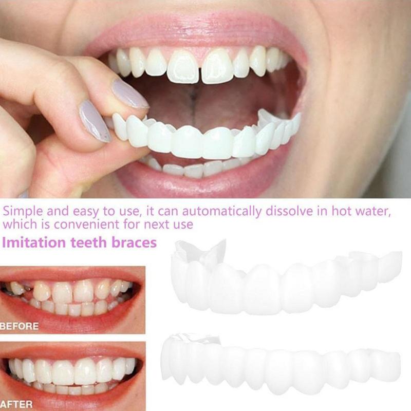 Chapa para dientes a presión,  - Teeth Whitening Veneers reseña y precio