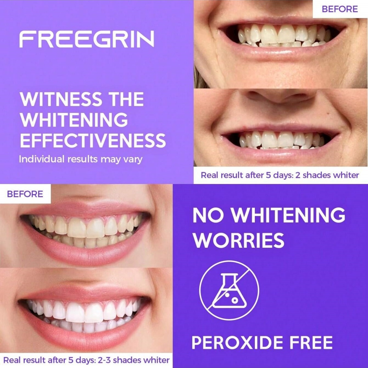 Pegatinas blanqueadoras de die - Teeth Whitening App reseña y precio