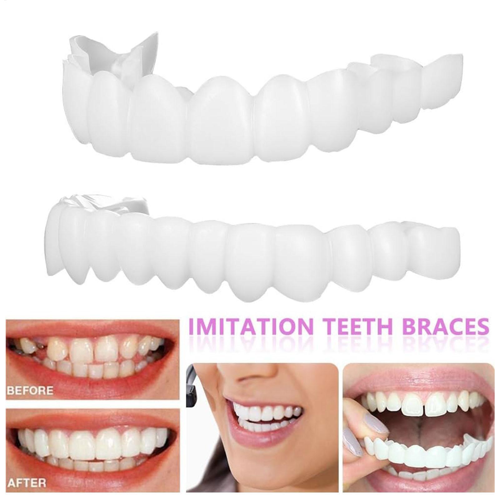 Chapa de dientes temporal para - Teeth Whitening Veneers reseña y precio