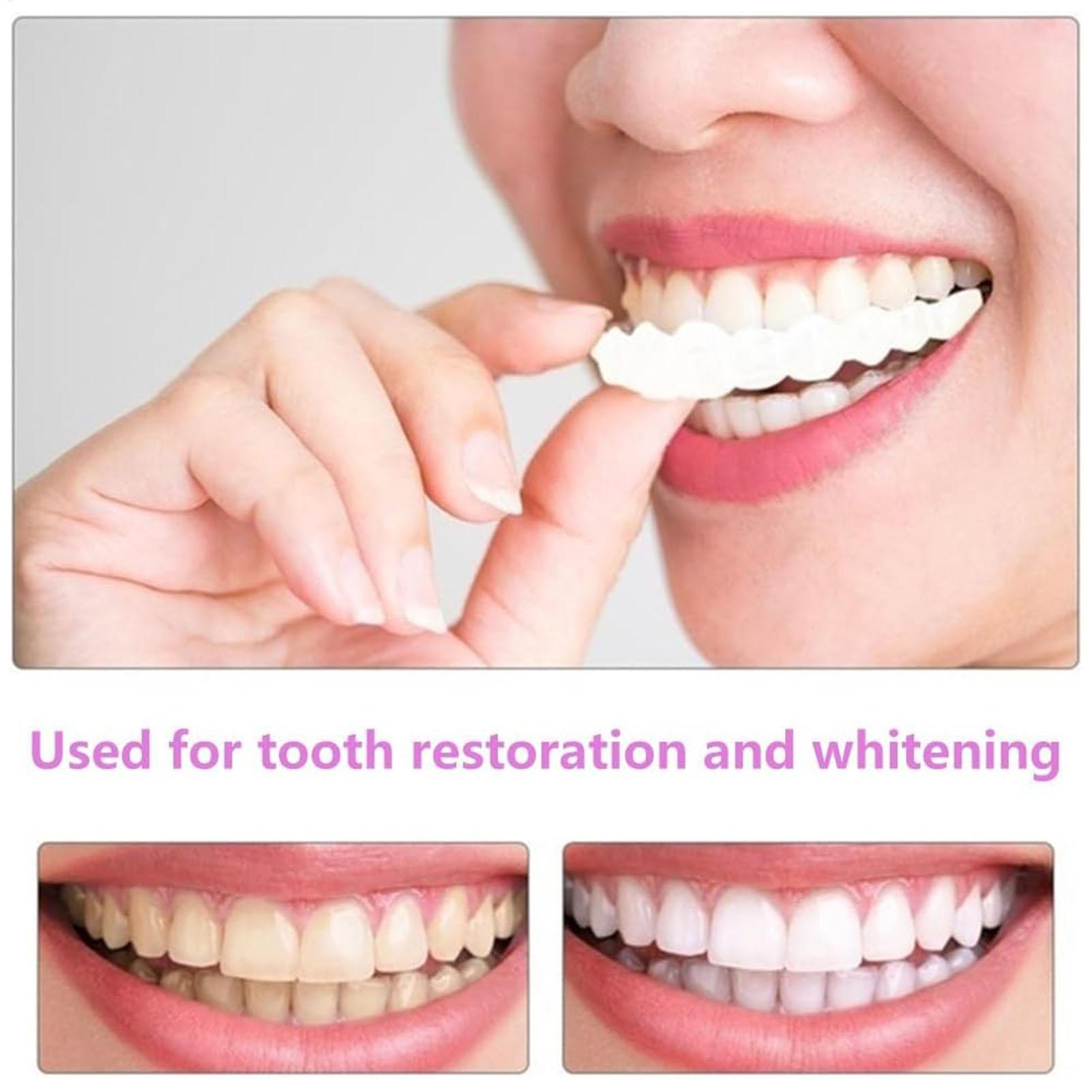 Chapa de dientes temporal para - Teeth Whitening Veneers reseña y precio