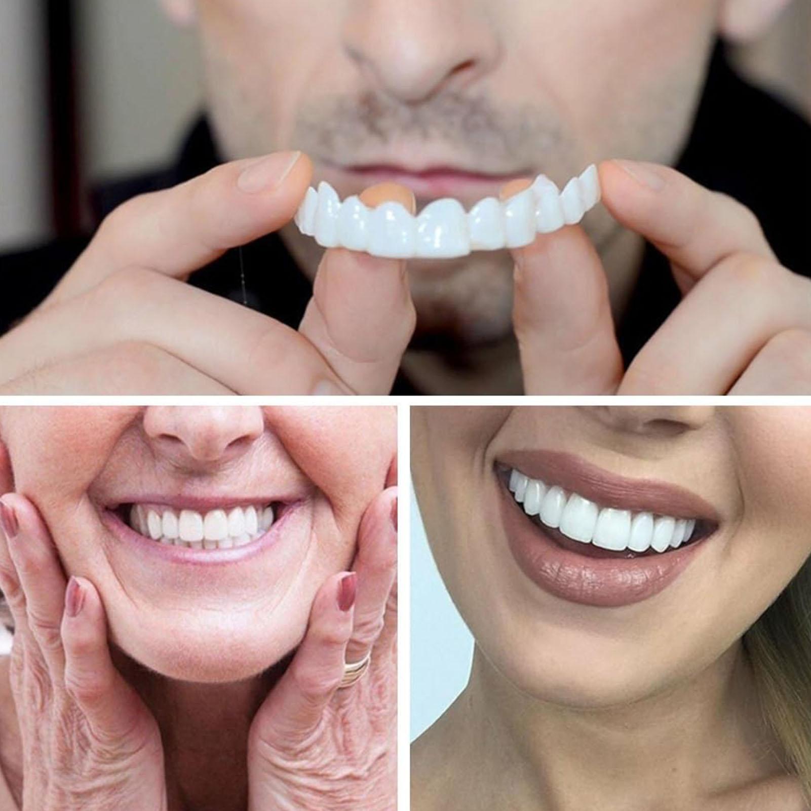 Chapa de dientes temporal para - Teeth Whitening Veneers reseña y precio